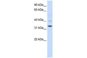 Crystallin Zeta antibody used at 1 ug/ml to detect target protein.