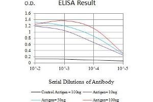 Black line: Control Antigen (100 ng),Purple line: Antigen (10 ng), Blue line: Antigen (50 ng), Red line:Antigen (100 ng) (KAT6B anticorps  (AA 1186-1318))