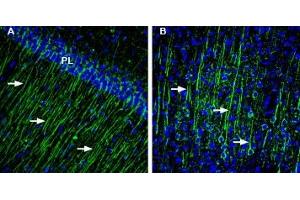 Expression of KCNMB4 in rat hippocampus and cortexImmunohistochemical staining of perfusion-fixed frozen rat brain sections with Anti-sloβ4 (KCNMB4) Antibody (ABIN7581910), (1:200), followed by goat-anti-rabbit-AlexaFluor-488.