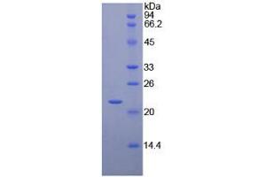 SDS-PAGE analysis of Chicken Interferon beta Protein. (IFNB1 Protéine)