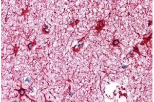 Human Brain, Cortex: Formalin-Fixed, Paraffin-Embedded (FFPE) (GFAP anticorps)