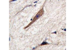 IHC analysis of FFPE human brain tissue stained with PAK5 antibody