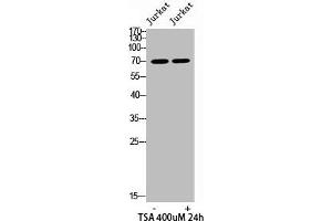 Western blot analysis of JK lysis using Acetyl-Ku-70 (K542) antibody.