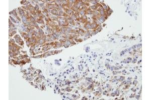 IHC-P Image Immunohistochemical analysis of paraffin-embedded A549 xenograft, using PRPSAP2, antibody at 1:500 dilution.