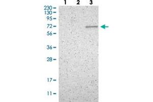 Western blot analysis of Lane 1: Human cell line RT-4 Lane 2: Human cell line U-251MG sp Lane 3: Human plasma (IgG/HSA depleted)  with ZNF37A polyclonal antibody  at 1:100-1:250 dilution. (ZNF37A anticorps)