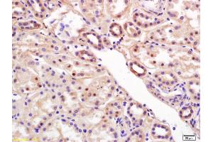 Formalin-fixed and paraffin embedded human kidney labeled with Rabbit Anti RCL/c Myc responsive Polyclonal Antibody, Unconjugated (ABIN872485) at 1:200 followed by conjugation to the secondary antibody and DAB staining (RCL anticorps  (AA 101-174))