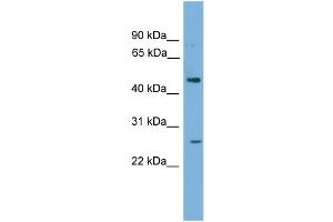 WB Suggested Anti-HLX Antibody Titration: 0. (HLX anticorps  (Middle Region))
