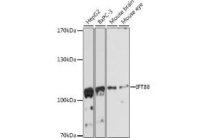 Western blot analysis of extracts of various cell lines, using IFT88 antibody (ABIN6131798, ABIN6142226, ABIN6142227 and ABIN6216899) at 1:3000 dilution. (IFT88 anticorps  (AA 534-833))