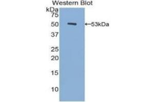WB of Protein Standard: different control antibodies against Highly purified E. (Fibrinogen beta Chain Kit ELISA)
