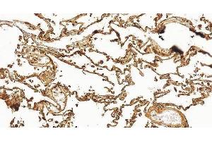 IHC analysis of RAGE/AGER using anti-RAGE/AGER antibody (ABIN7601722). (RAGE anticorps  (AA 43-404))