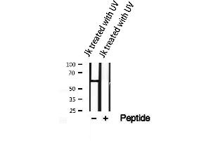 Western blot analysis of extracts from JK treated with UV, using Phospho-AKT1/2/3(Tyr315/316/312) Antibody. (AKT 1/2/3 anticorps  (pTyr312, pTyr315, pTyr316))