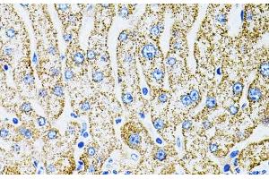 Immunohistochemistry of paraffin-embedded Human liver damage using EPO Polyclonal Antibody