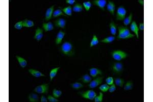 Immunofluorescence staining of Hela cells with ABIN7161453 at 1:133, counter-stained with DAPI. (NTSR2 anticorps  (AA 359-410))
