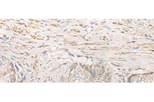 anti-Stomatin (EPB72)-Like 2 (STOML2) antibody