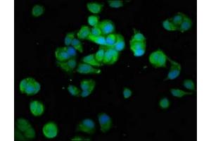 Immunofluorescence staining of MCF-7 cells with ABIN7160049 at 1:100, counter-stained with DAPI.