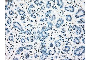 Image no. 9 for anti-Sjogren Syndrome Antigen B (SSB) antibody (ABIN1501143)