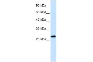 RGS13 antibody used at 1. (RGS13 anticorps  (Middle Region))