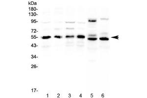 Western blot testing of human 1) HeLa, 2) COLO320, 3) A431, 4) MCF7, 5) rat heart and 6) mouse heart lysate with RXRA antibody at 0. (Retinoid X Receptor alpha anticorps)