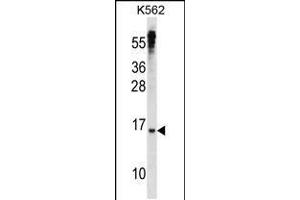 Western blot analysis in K562 cell line lysates (35ug/lane). (MXD3 anticorps  (N-Term))