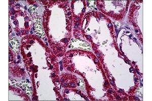 anti-H/K/N-Ras (N-Term) antibody