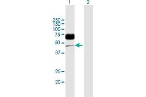 Western Blot analysis of CD96 expression in transfected 293T cell line by CD96 MaxPab polyclonal antibody.