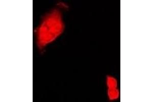 Immunofluorescent analysis of CIRBP staining in Hela cells.