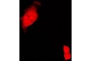 Immunofluorescent analysis of CIRBP staining in Hela cells. (CIRBP anticorps)