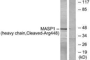 Western blot analysis of extracts from A549 cells, treated with etoposide (25uM, 24hours), using MASP1 (heavy chain, Cleaved-Arg448) antibody. (MASP1 anticorps  (Cleaved-Arg448))