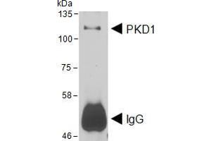 HEK293 lysate overexpressing Human DYKDDDDK-tagged PKD1 was used to immunoprecipitate PKD1 with 2ug ABIN5539576. (PKC mu anticorps  (AA 383-395))