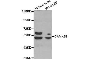 Western blot analysis of extracts of various cell lines, using CAMK2B antibody. (CAMK2B anticorps  (AA 1-300))
