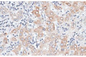 Immunohistochemistry of paraffin-embedded Human liver using GPC4 Polyclonal Antibody at dilution of 1:100 (40x lens). (GPC4 anticorps)