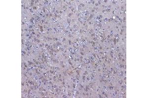 IHC testing of FFPE rat brain tissue with GSTM3 antibody at 1ug/ml. (GSTM3 anticorps)