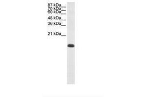Image no. 2 for anti-Zinc Finger Protein 786 (ZNF786) (N-Term) antibody (ABIN203008) (ZNF786 anticorps  (N-Term))
