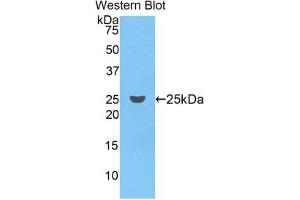 Western blot analysis of the recombinant protein. (Coagulation Factor IX anticorps  (AA 61-263))