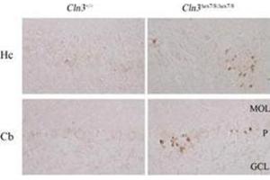 Wild-type (Cln3+/+) or homozygous Cln3ex7/8 (Cln3ex7/8/ex7/8) paraffin-embedded brain sections immunostained for the LC3 protein (Autophagy LC3B Antibody ).
