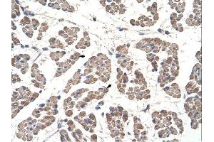GCDH antibody was used for immunohistochemistry at a concentration of 4-8 ug/ml. (GCDH anticorps  (C-Term))