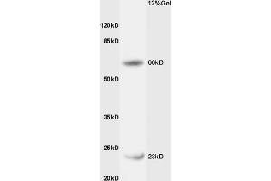 Rat liver lysates probed with Rabbit Anti-CPT1B Polyclonal Antibody (ABIN708851) at 1:200 in 4 °C. (CPT1B anticorps  (AA 501-600))