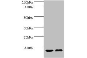 Western blot All lanes: COTL1 antibody at 5 μg/mL Lane 1: Mouse brain tissue Lane 2: Mouse kidney tissue Secondary Goat polyclonal to rabbit IgG at 1/10000 dilution Predicted band size: 16 kDa Observed band size: 16 kDa (COTL1 anticorps  (AA 1-142))