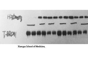 Western Blot (WB) analysis: Please contact us for more details. (BRCA1 anticorps  (Ser183))