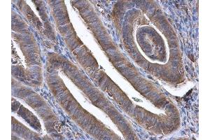 IHC-P Image GBP3 antibody [N1C1] detects GBP3 protein at cytoplasm in human endometrium by immunohistochemical analysis. (GBP3 anticorps)