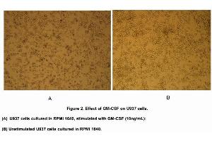 Cell differentiation of U937 cells after incubation with GM-CSF (10ng/mL) for 5 days was shown in Figure 2.