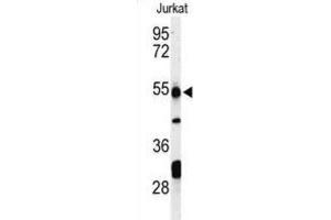 Western Blotting (WB) image for anti-Prune Exopolyphosphatase (PRUNE) antibody (ABIN3004302) (PRUNE anticorps)