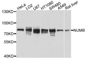 Western blot analysis of extracts of various cell lines, using NUMB antibody (ABIN5996190) at 1/1000 dilution. (NUMB anticorps)
