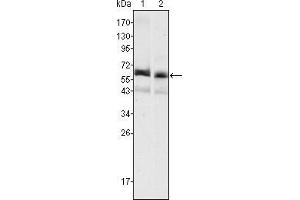 Western blot analysis using AFP mouse mAb against HepG2 (1) and SMMC-7721 (2) cell lysate. (alpha Fetoprotein anticorps)