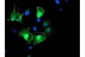 Image no. 3 for anti-Low Density Lipoprotein Receptor Adaptor Protein 1 (LDLRAP1) antibody (ABIN1496687) (LDLRAP1 anticorps)