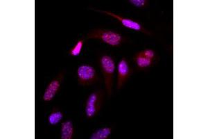 Immunofluorescence (IF) image for anti-Small Ubiquitin Related Modifier 2 (SUMO2) (AA 1-93), (N-Term) antibody (ABIN492386) (SUMO2 anticorps  (N-Term))