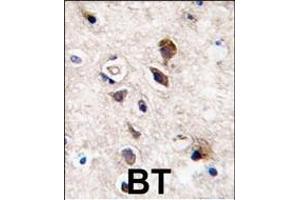 Formalin-fixed and paraffin-embedded human brain tissue reacted with PKC gamma antibody (C-term), which was peroxidase-conjugated to the secondary antibody, followed by DAB staining.