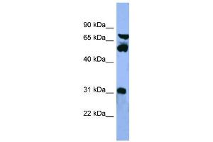 WB Suggested Anti-CYP8B1 Antibody Titration: 0.