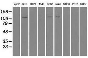 Image no. 5 for anti-Budding Uninhibited By Benzimidazoles 1 Homolog beta (Yeast) (BUB1B) antibody (ABIN1497002)