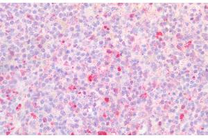 Detection of BST1 in Human Spleen Tissue using Polyclonal Antibody to Bone Marrow Stromal Cell Antigen 1 (BST1)